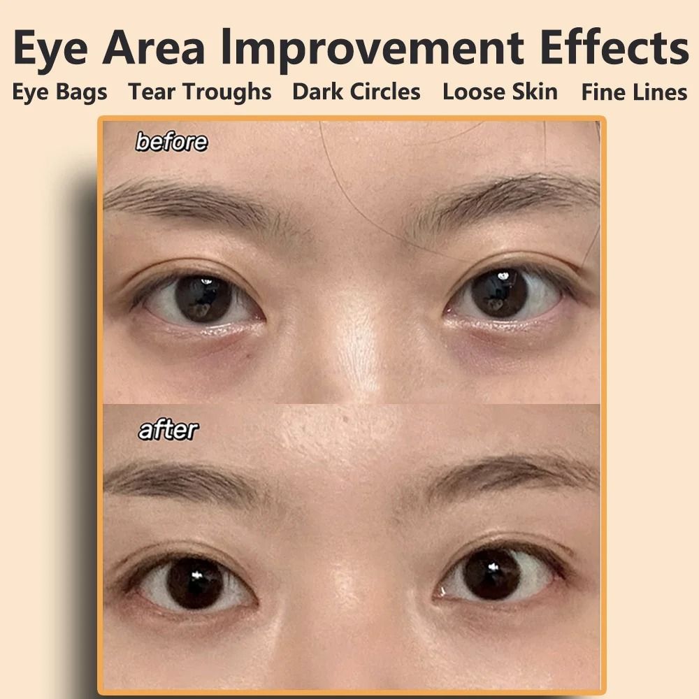 EMS Eye And Face Beauty Massager Muscle Stimulator 2
