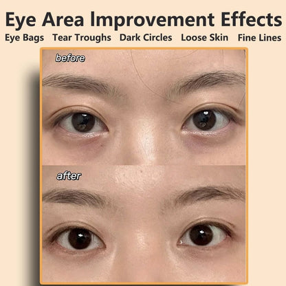 EMS Eye And Face Beauty Massager Muscle Stimulator 2