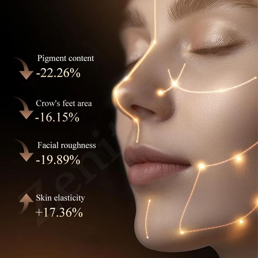 DPL Milk Light Skin Rejuvenation And Whitening Device 4