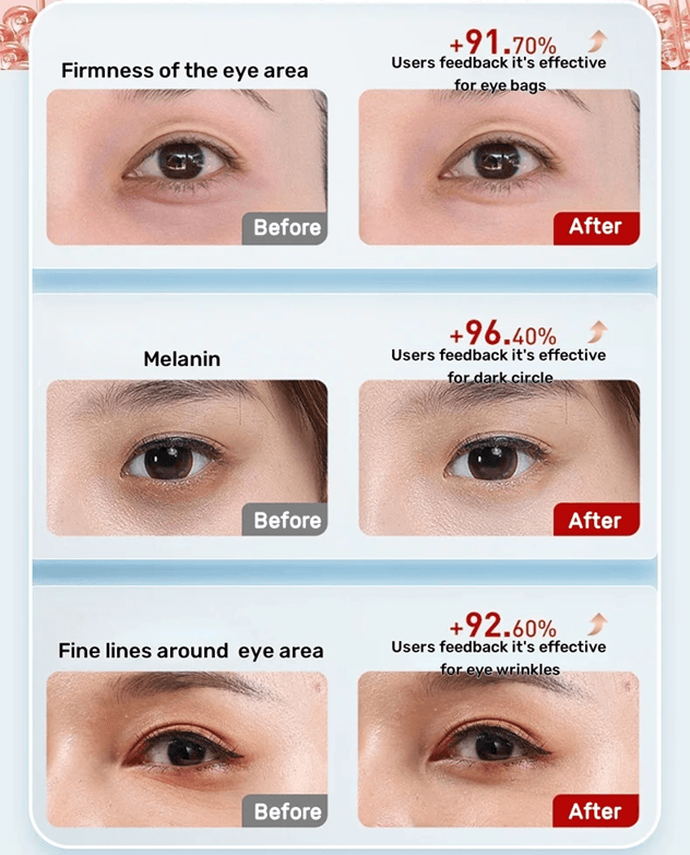 7 Color LED Eye Massager With Heat And Vibration For Dark Circles And Eyelid Lifting 3