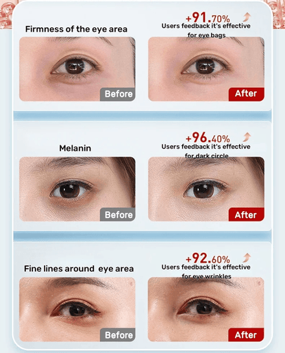 7 Color LED Eye Massager With Heat And Vibration For Dark Circles And Eyelid Lifting 3