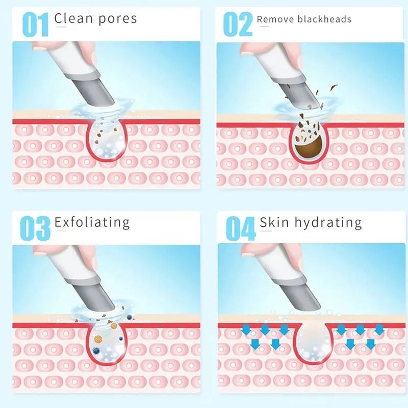 Hydra Dermabrasion Aqua Facial Device With Oxygen Injection And Blackhead Suction 6