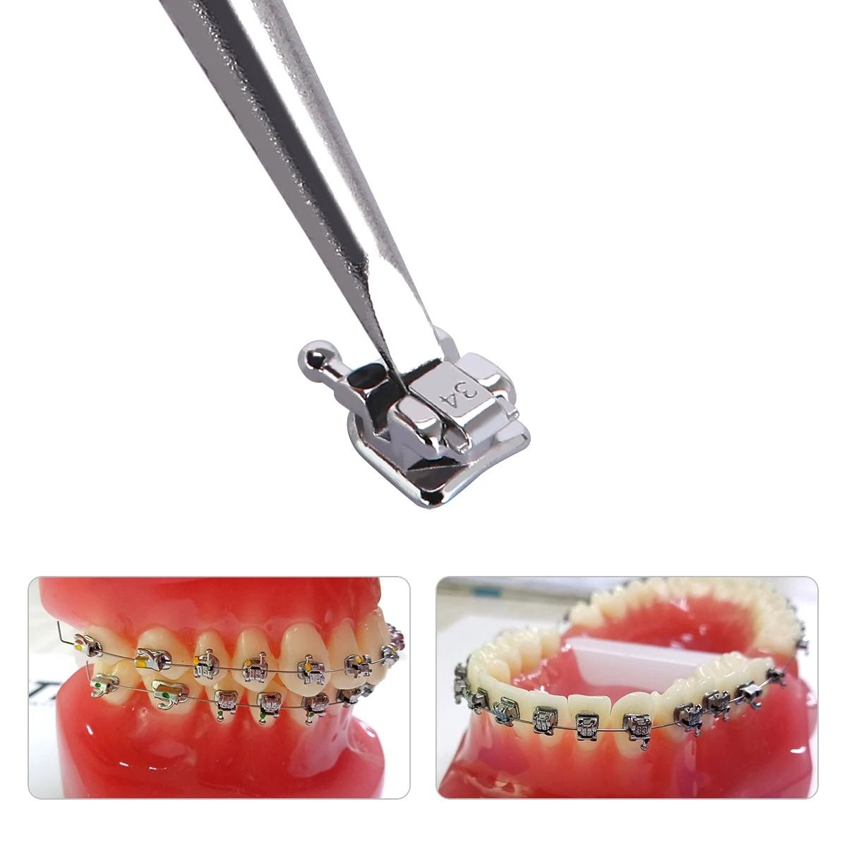 5 Box Self Ligating Orthodontic Brackets With Buccal Tubes And Hooks 4