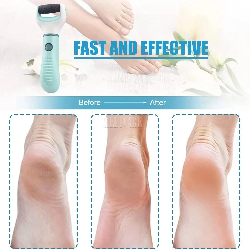 Electric Foot Grinder Pedicure Tool For Dead Skin And Calluses 2