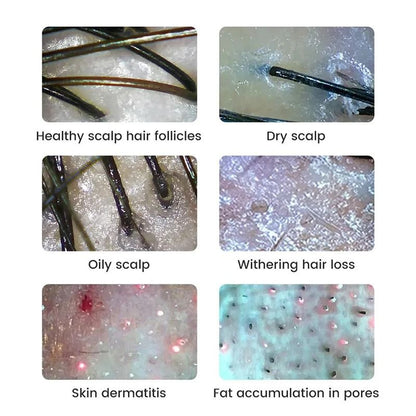 Wireless Digital Skin And Scalp Analyzer With WiFi Connection And High Precision Facial Magnifier M 4
