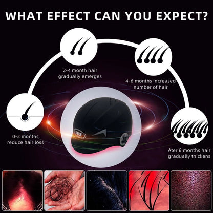 Laser Hair Regrowth Cap With Low Level Light Therapy 3