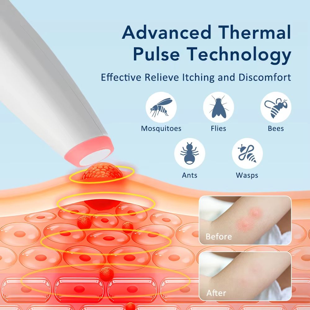 Portable Mosquito Bite Relief Pen Chemical Free Rechargeable AntiItch Device For Adult And Child 2