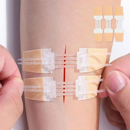 3 Piece Wound Closure Zipper Patch Hemostatic Emergency Device