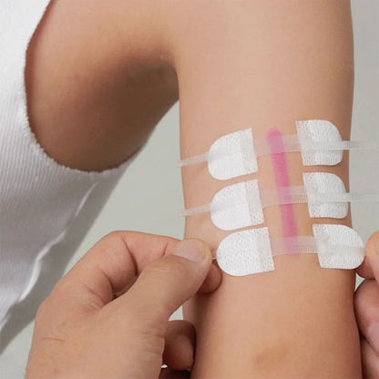 3 Piece Wound Closure Zipper Patch Hemostatic Emergency Device 1