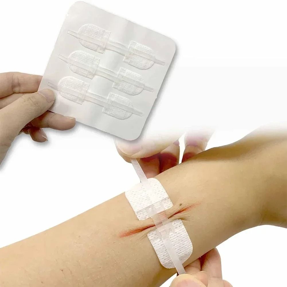 3 Piece Wound Closure Zipper Patch Hemostatic Emergency Device 2