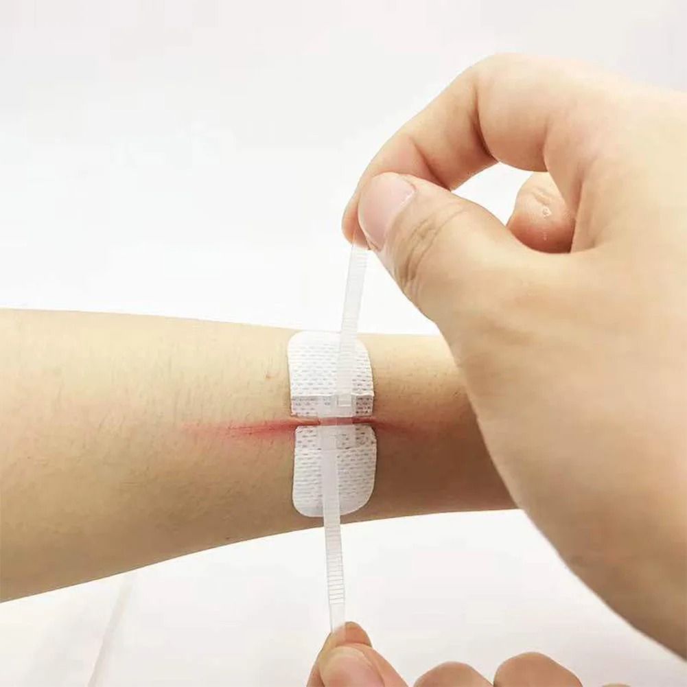 3 Piece Wound Closure Zipper Patch Hemostatic Emergency Device 3