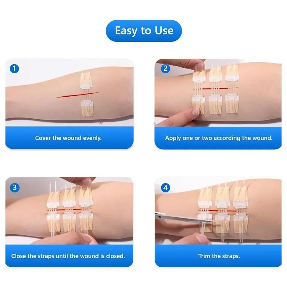 3 Piece Wound Closure Zipper Patch Hemostatic Emergency Device 4