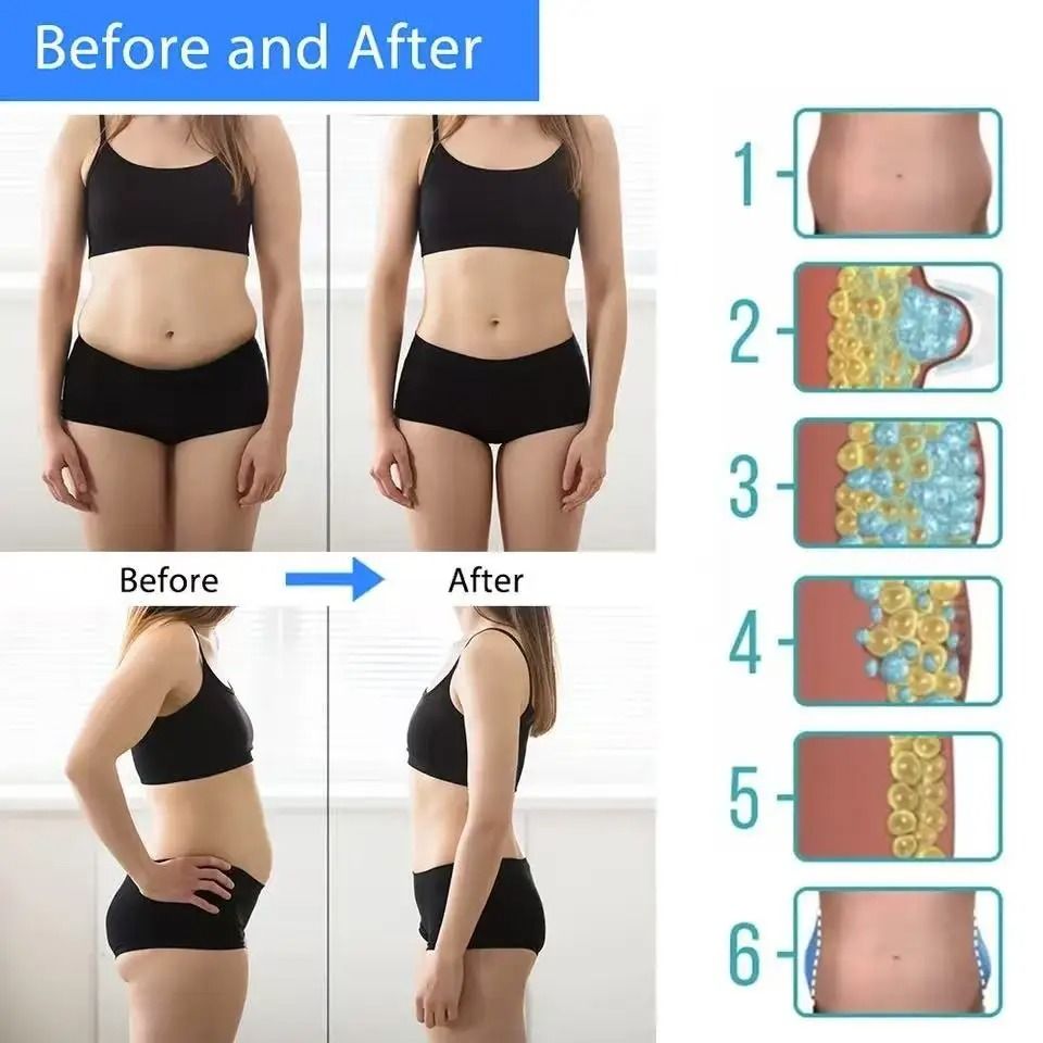 Cold Therapy Slimming Device For Body Contouring 3