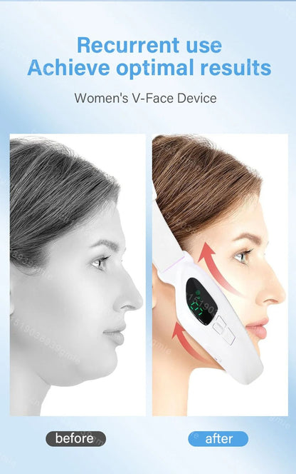 Electric Face Slimming And Lifting Massager 5