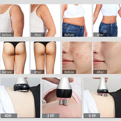 40K Ultrasonic Cavitation Machine Body Slimming Beauty Skin Massage Radiofrecuencia Corporal Facial 4