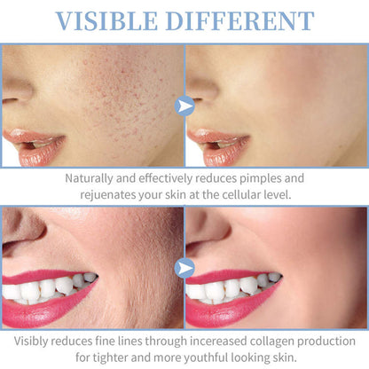 Portable High Frequency Skin Therapy Wand Handheld Facial Machine For Acne Massage Skin Rejuvenatio 2