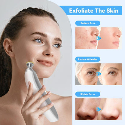 Upgraded Diamond Microdermabrasion Machine Blackhead Removal Professional Facial Deep Cleasing Devi 1