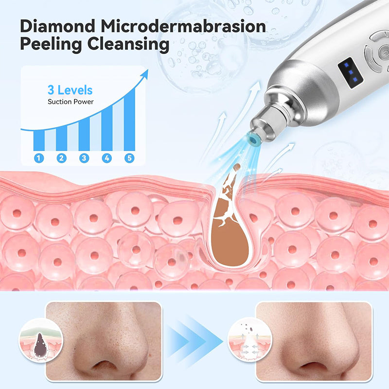 Upgraded Diamond Microdermabrasion Machine Blackhead Removal Professional Facial Deep Cleasing Devi 2
