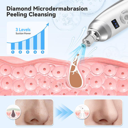 Upgraded Diamond Microdermabrasion Machine Blackhead Removal Professional Facial Deep Cleasing Devi 2