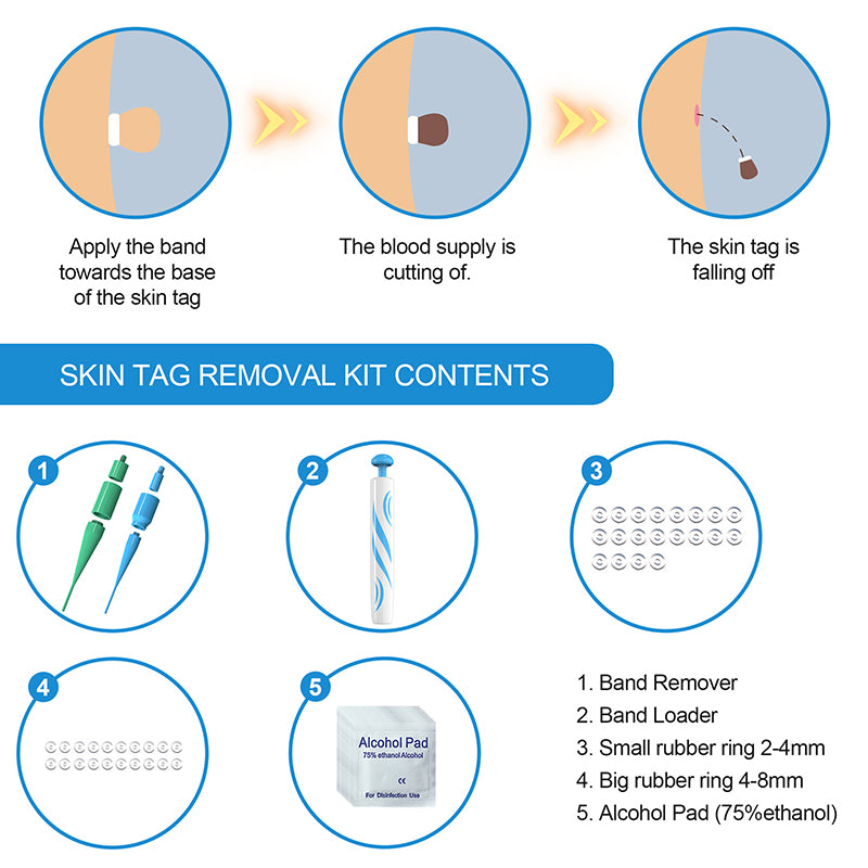 2 in 1 Auto Micro Skin Tag Remover Device Kit, Standard Face Cleaner for Adult Mole, Wart, Black Dots Remover, Painless