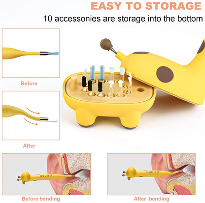 Bebird D3 Pro Kids Use Smart Visual Earpick Ear Cleaner, Otoscope for Safe Earwax Removal Waterproof Child Endoscope