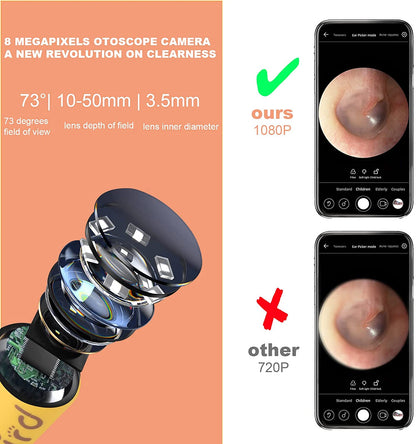 Bebird D3 Pro Kids Use Smart Visual Earpick Ear Cleaner, Otoscope for Safe Earwax Removal Waterproof Child Endoscope
