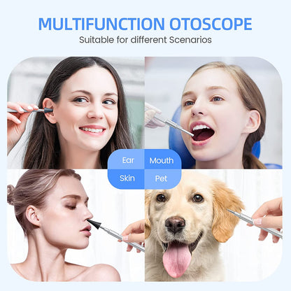 Professional Digital Otoscope with Screen Ear Camera, LED Lights, High GB Storage, Specula, Ear Wax Removal Kit