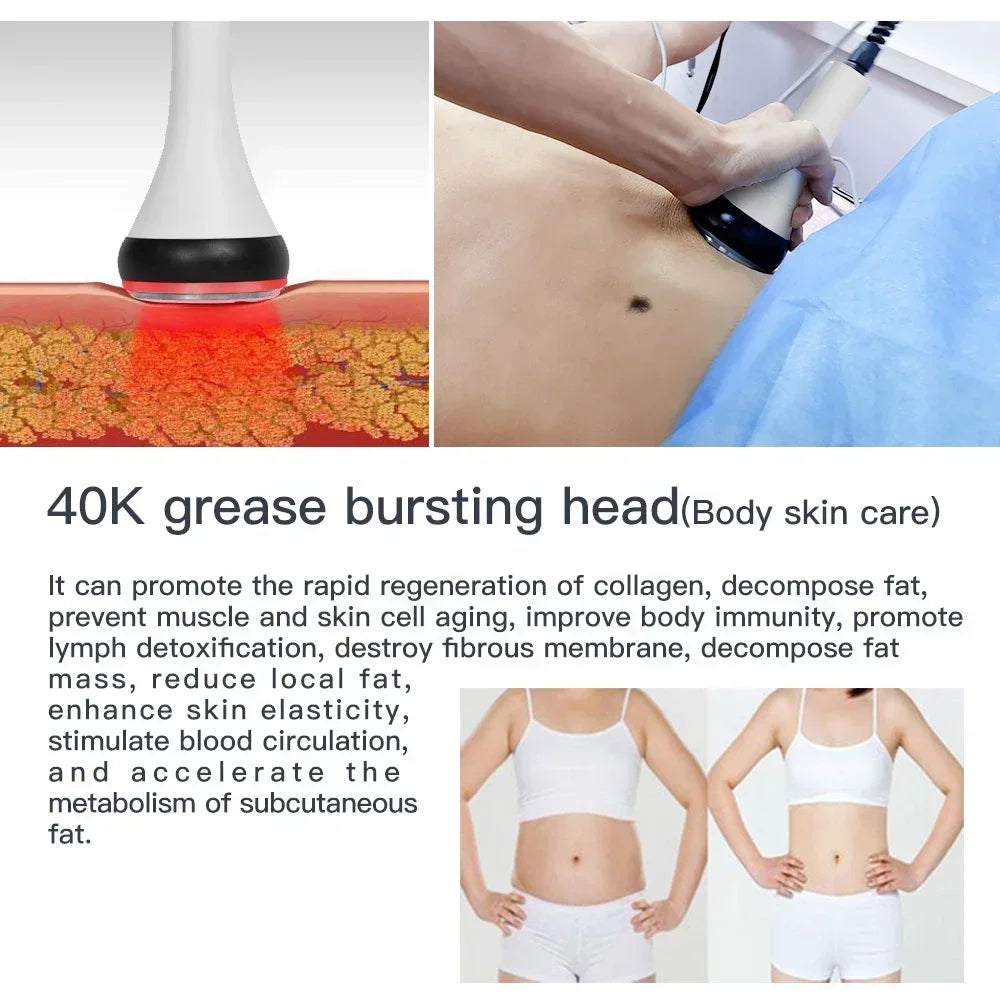 Professional 40K Ultrasonic Cavitation Machine With RF EMS For Radiofrecuencia Corporal Facial Lift 3