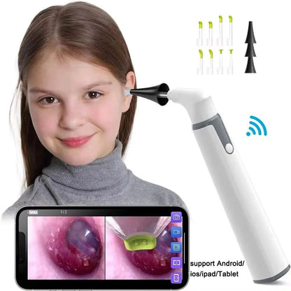 Wireless Otoscope Ear Camera – 1080P HD WiFi Ear Scope with LED Lights for Kids & Adults