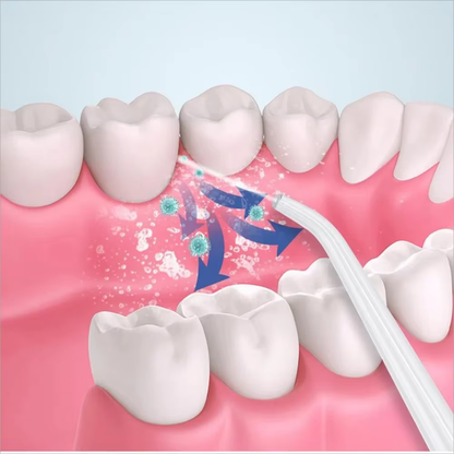 Dental Water Flosser Oral Irrigator Portable Electric Tooth Cleaner With 3 Modes For NoHarm Teeth C 1