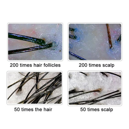 10Inch LCD Hair And Skin Analyzer  Digital Microscope With 50X200X Magnification For Scalp  Follicl 2