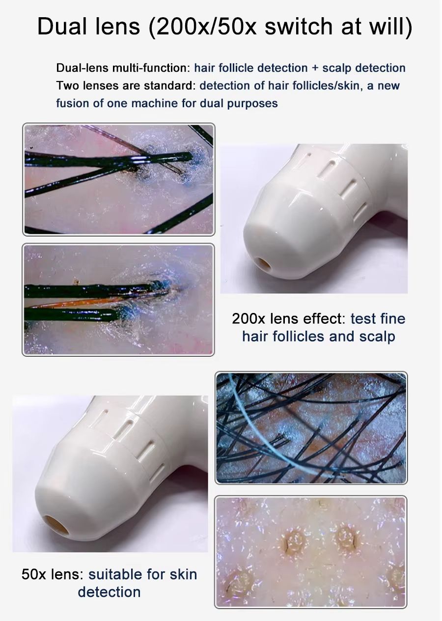 10Inch LCD Hair And Skin Analyzer  Digital Microscope With 50X200X Magnification For Scalp  Follicl 5