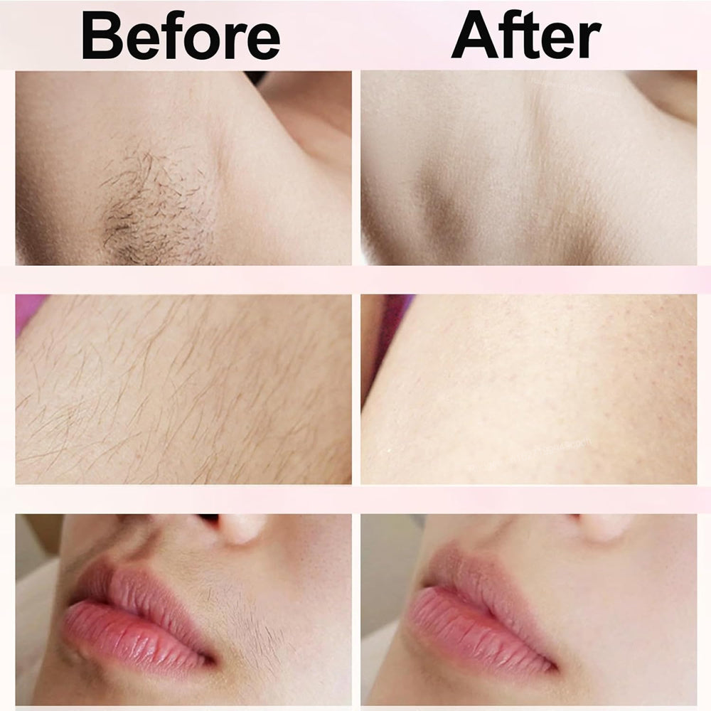 Electric Razors For Women 2in1 Painless Bikini Trimmer  Facial Shaver For Ladies Body Underarms Leg 5