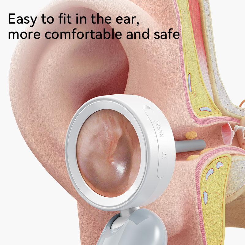 Visual Ear Camera with 1.38 IPS Screen 1080P HD Wireless Endoscope for Ear Wax Cleaning, Inspection, Video, Picture
