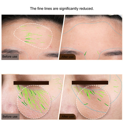 Professional EMS Facial  Body Radio Frequency Machine RF Skin Tightening Face Lifting Beauty Device 2