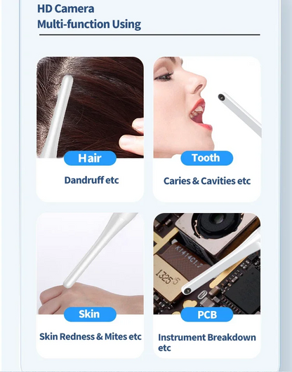 Wireless Visual Camera HD 1080P 2 Megapixel Intraoral Skin Examination Kit For IOS Android Mac  PC 4