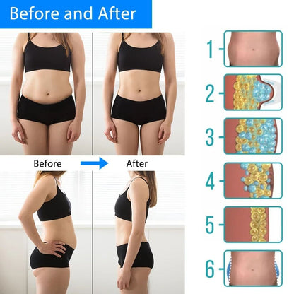 Cryotherapy Fat Freezing Slimming Machine For Abdominal And Body Sculpting 4