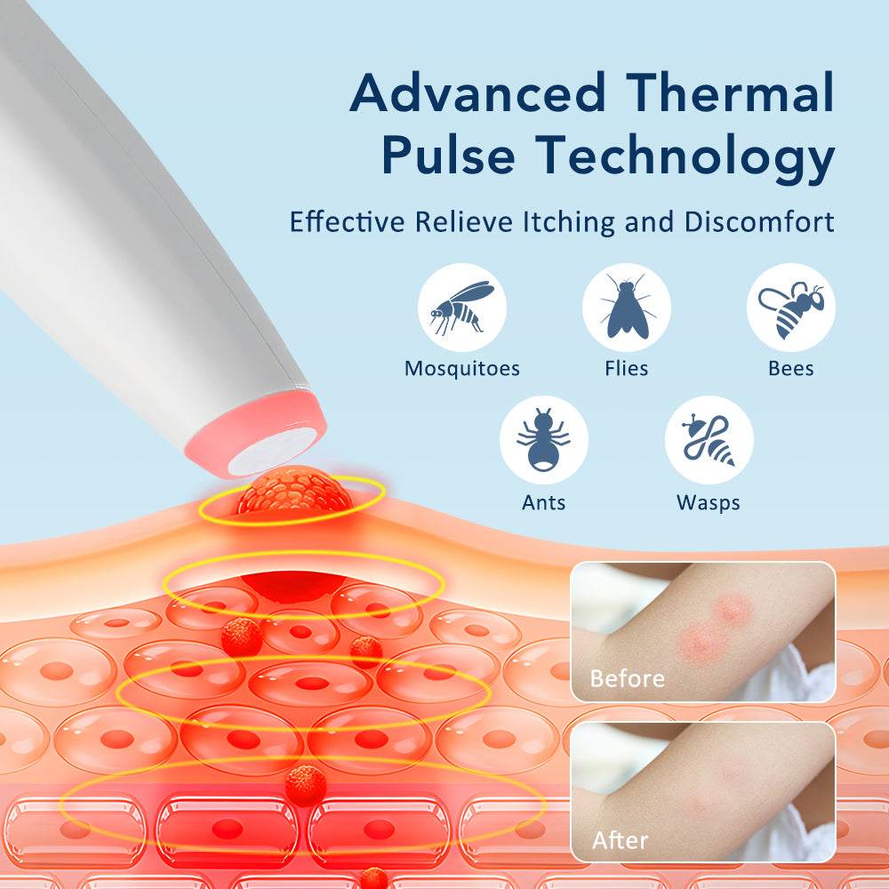 Rechargeable Portable Mosquito Insect Bite Relieve Itching Pen ChemicalFree Natural AntiItch Bug Bi 3