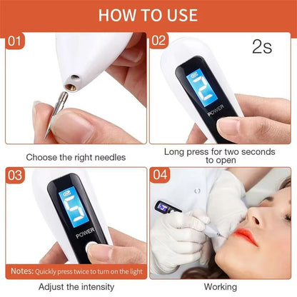 UBilli Plasma Beauty Pen  Laser Skin Tag Remover Freckle  Tattoo Removal Tool For Spot Care 1