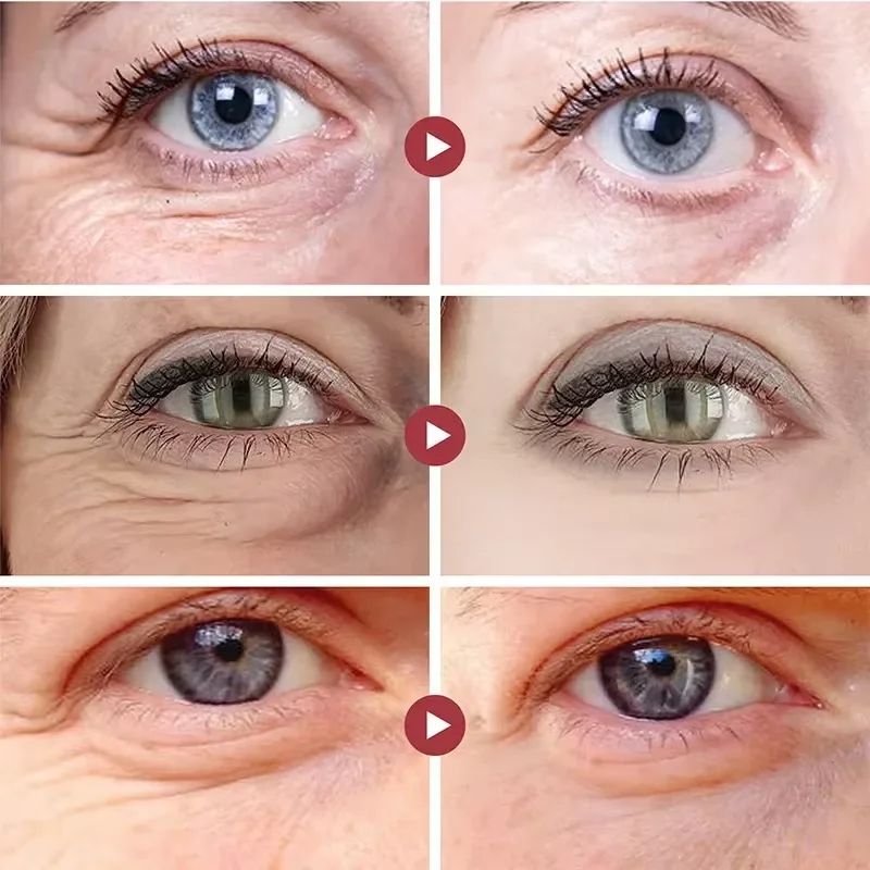 Retinol Eye Cream For Dark Circles Fade Fine Lines Lift Tighten Eye Skin Anti Aging Wrinkle Remover 2