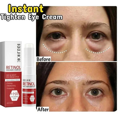Instant Eye Bag Remove Eye Cream Korean Beauty Eye Care Fade Dark Circles Puffiness Lift Brighten A