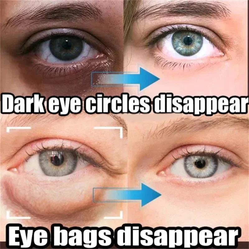 Instant Eye Bag Remove Eye Cream Korean Beauty Eye Care Fade Dark Circles Puffiness Lift Brighten A