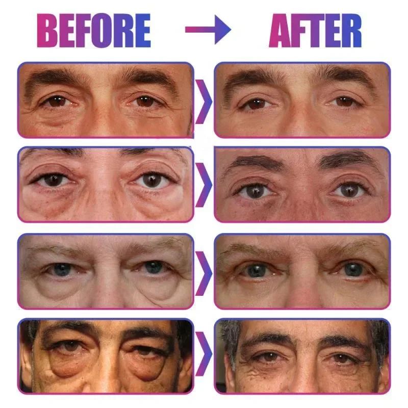 Instant Eye Bag Remove Eye Cream Korean Beauty Eye Care Fade Dark Circles Puffiness Lift Brighten A