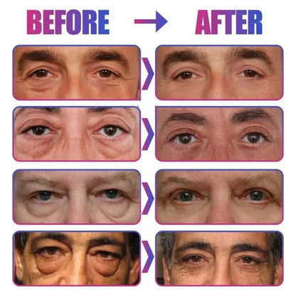 Instant Eye Bag Remove Eye Cream Korean Beauty Eye Care Fade Dark Circles Puffiness Lift Brighten A
