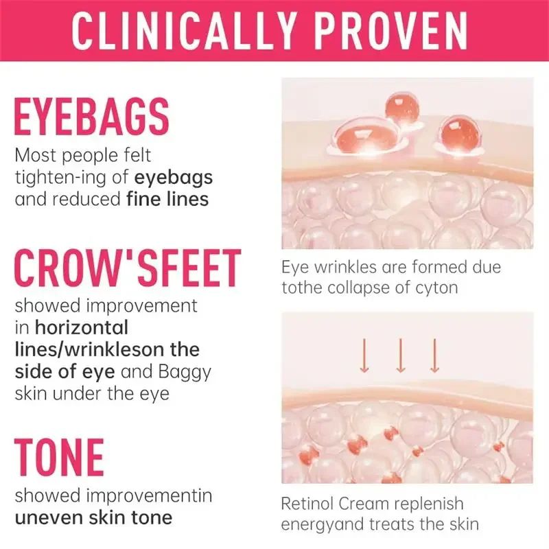 Retinol Instant Eye Bag Remove Cream AntiWrinkle Firming Fade Fine Lines Anti Dark Circle Puffiness 2