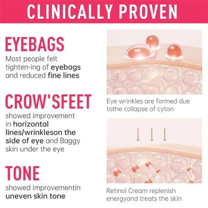 Retinol Instant Eye Bag Remove Cream AntiWrinkle Firming Fade Fine Lines Anti Dark Circle Puffiness 2