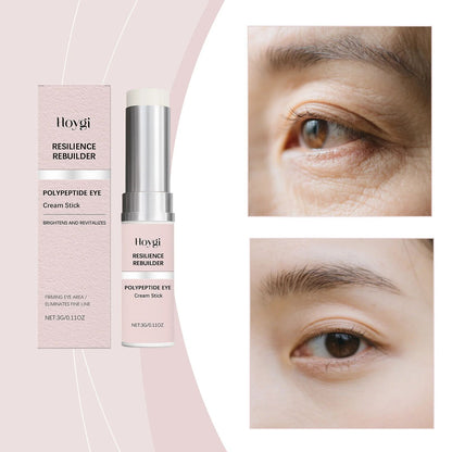 Moisturizing Nourishing Eye Cream Stick Care For Delicate Skin Around The Eyes Hydrating Wrinkle Re 4