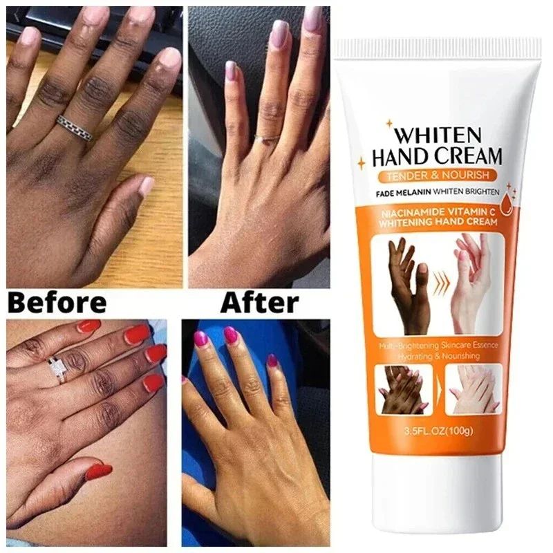 Dark Knuckles Brightening Serum Hand Anti Cracking Cream Moisturizer For Dark Skin Stains Remover A 1