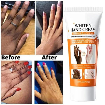 Dark Knuckles Brightening Serum Hand Anti Cracking Cream Moisturizer For Dark Skin Stains Remover A 1