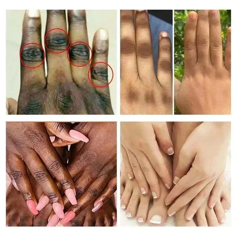 Dark Knuckles Brightening Serum Hand Anti Cracking Cream Moisturizer For Dark Skin Stains Remover A 2